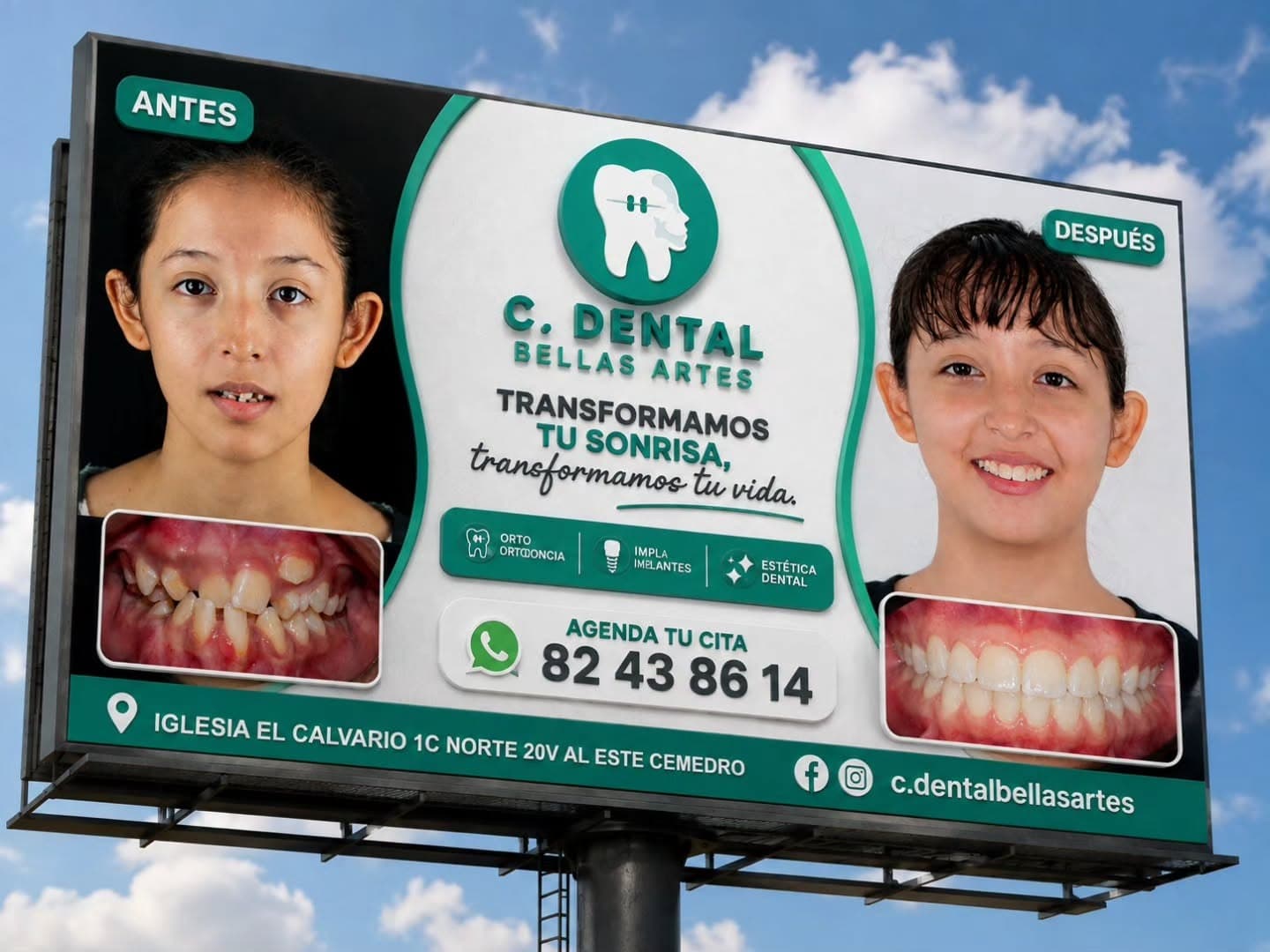 Valla publicitaria de Clínica Dental Bellas Artes sobre la calle, en Chinandega